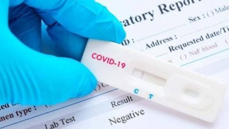 La Anmat autorizó el uso de cuatro test de autoevaluación de Covid-19